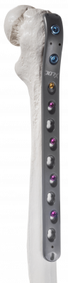 Femur-proximal_AF-Medical_156-1